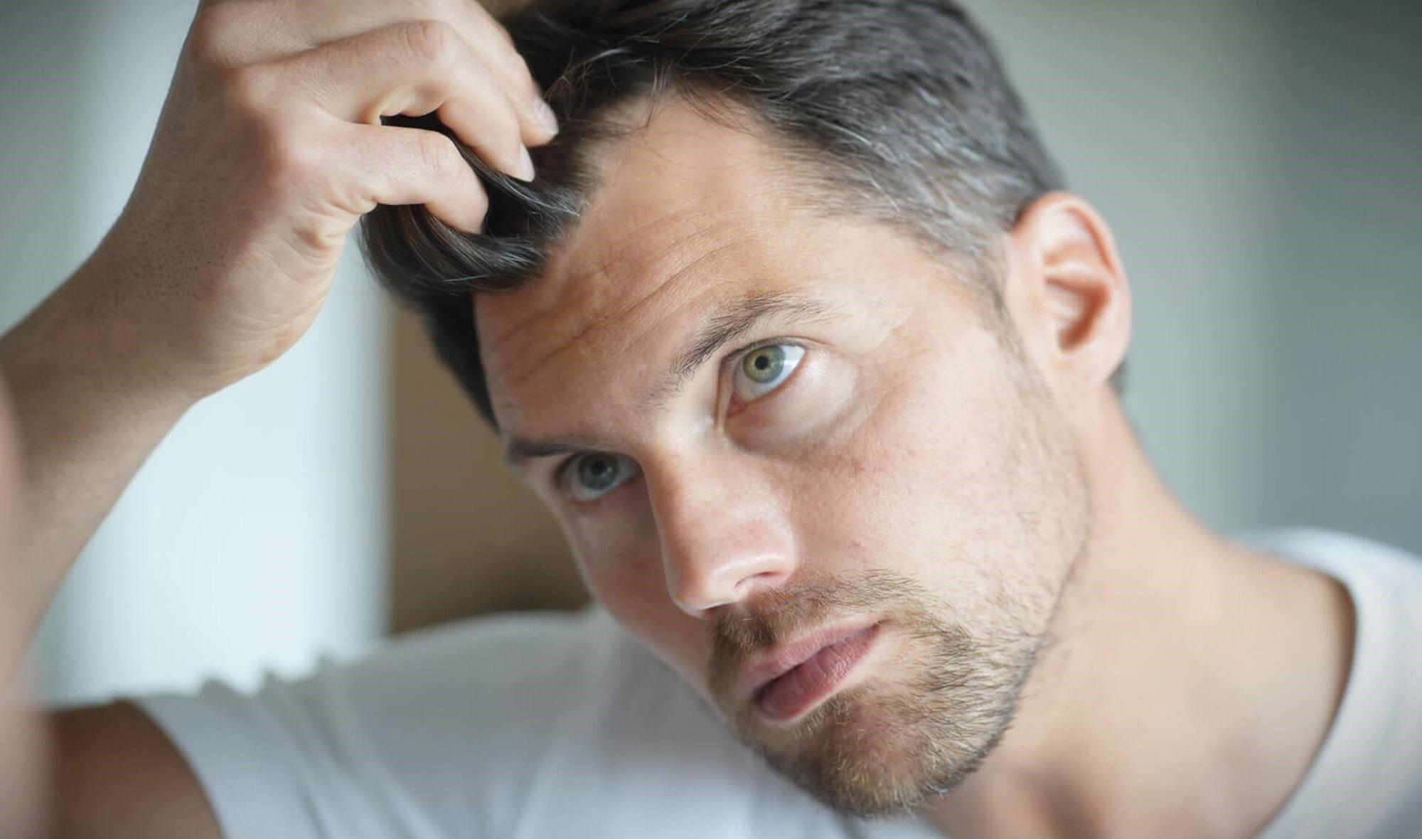 Haarausfall bei Männern: Was Dir wirklich hilft