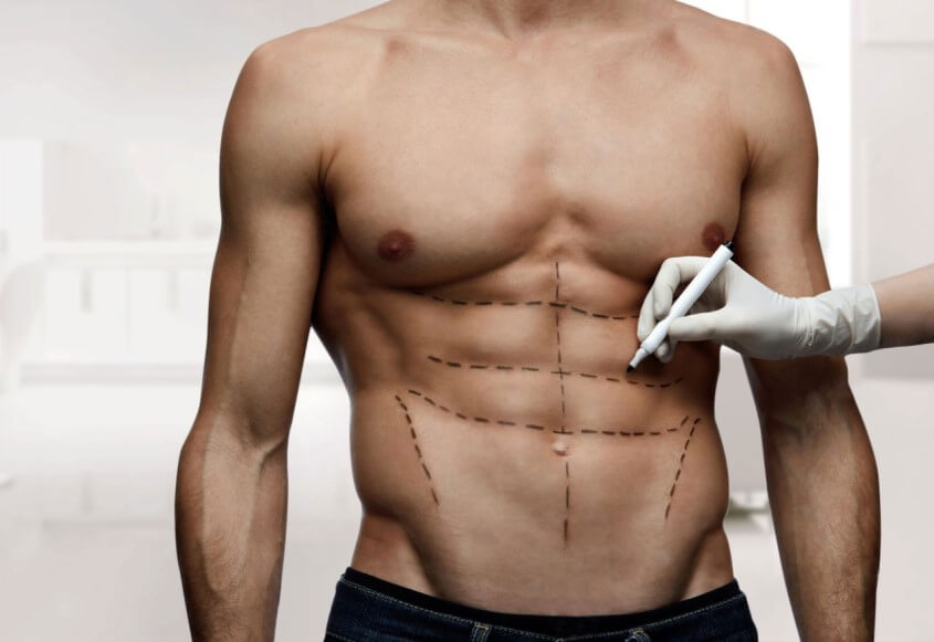 Sixpacktraining - So bekommst Du einen Waschbrettbauch