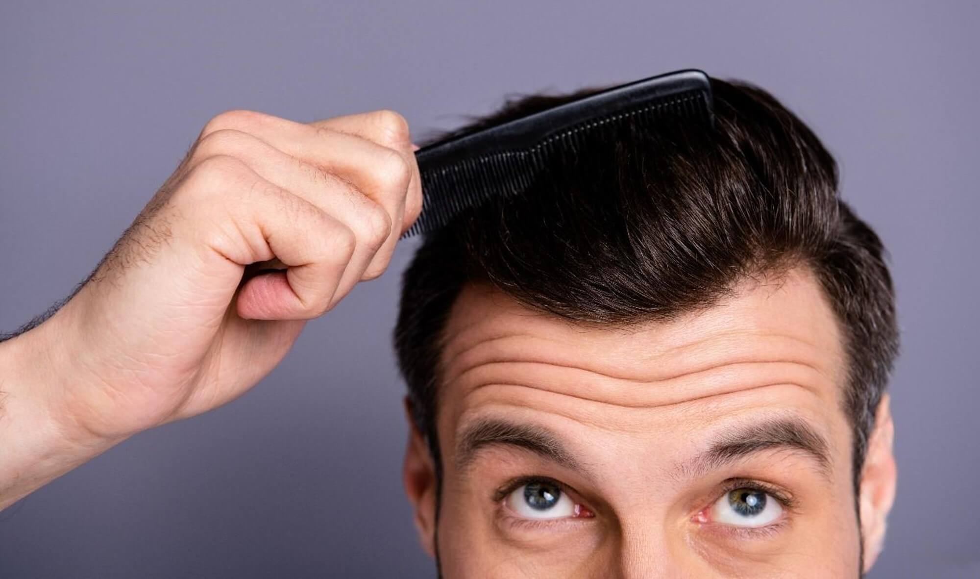 Was DIr wirklich bei Haarausfall hilft Haarausfall vorbeugen - Effektive Hilfe gegen Haarverlust finden