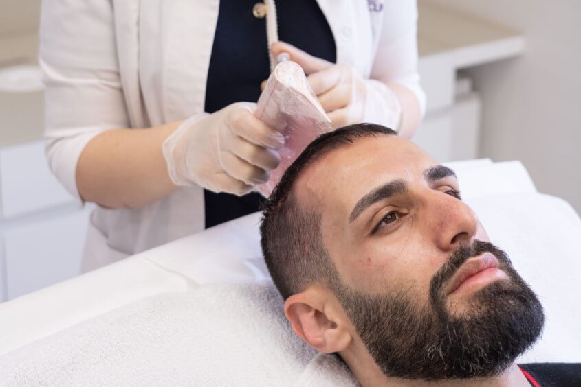 Expertentipps gegen Haarausfall