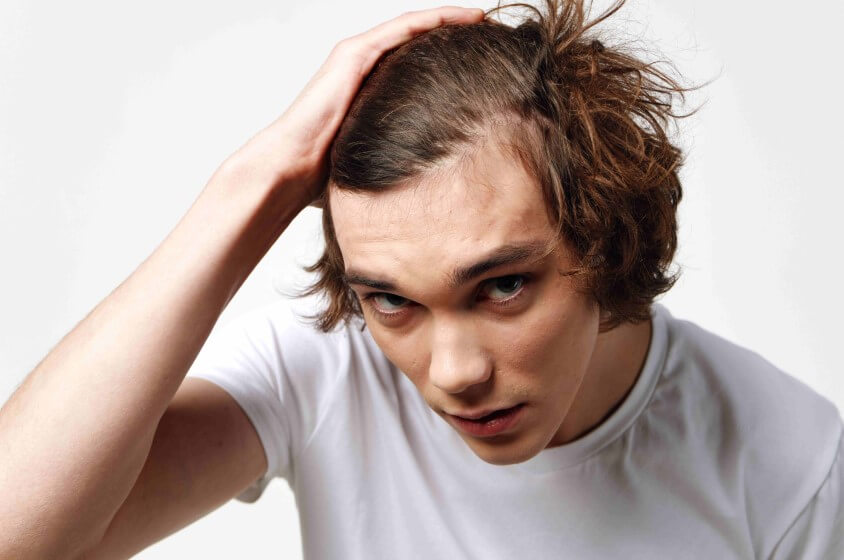 Ursachen für Haarausfall
