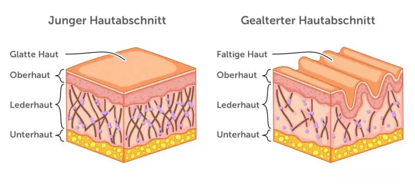Infografik: Vergleich junge vs. alte Haut